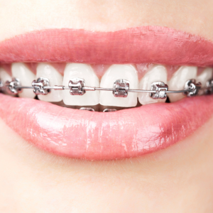 lorem-ipsum-stry039s-standard-1